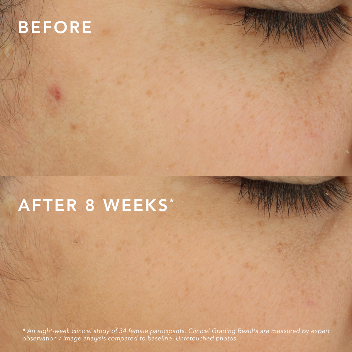 C-Bright Dark Spot Corrector